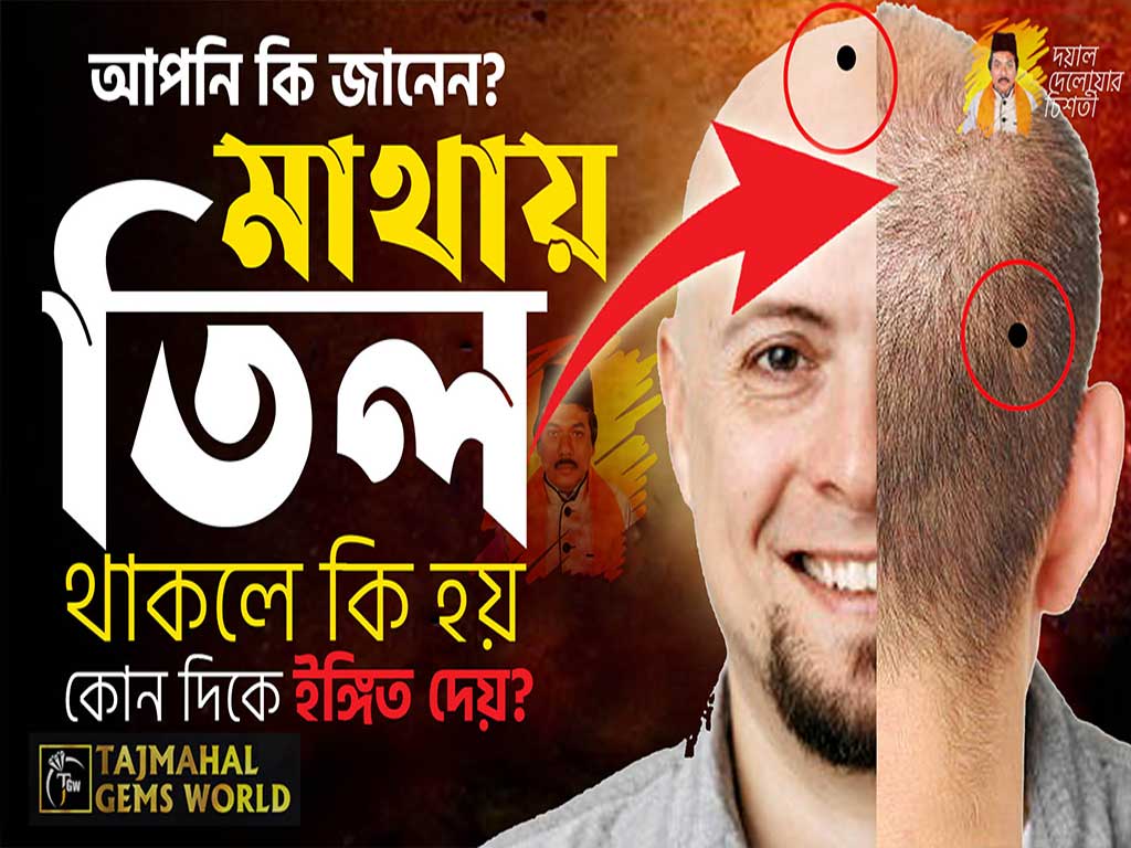 ভাগ্যবানদের মাথায় তিল থাকে? কোন দিকে ইঙ্গিত দেয়? আপনি কি জানেন? www.tajmahalgemsworld.com/