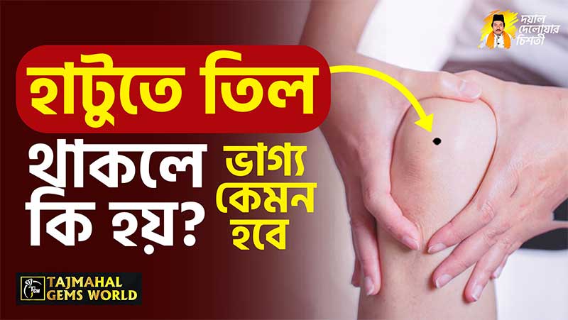 হাটুতে-তিল-থাকলে-কি-হয়-tajmahalgemsworld.com